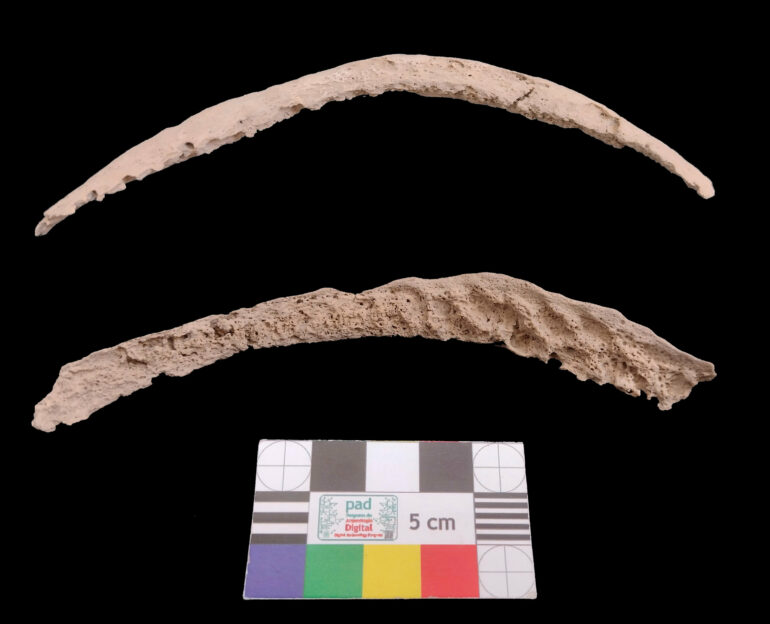 Syphilis had its roots in the Americas, archaeological bone study ...