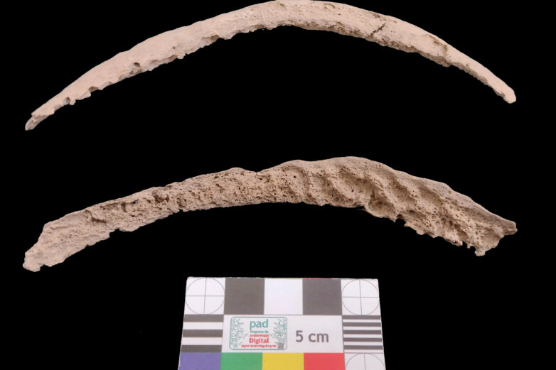 Syphilis had its roots in the Americas, archaeological bone study ...