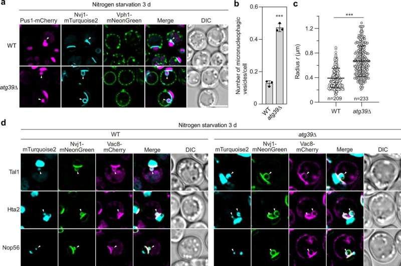 Elucidating the mechanism that prevents cell death caused by uncontrolled nuclear autophagy