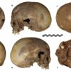 Analysis of skull from Ephesos confirms it is not Cleopatra's sister