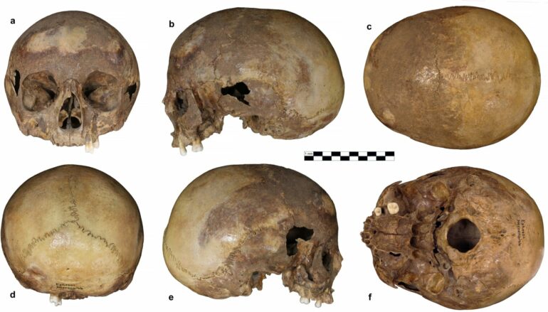 Analysis of skull from Ephesos confirms it is not Cleopatra's sister