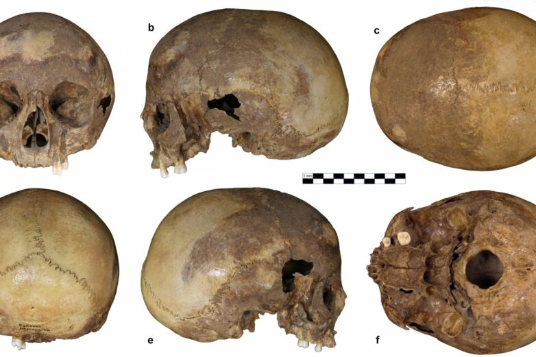 Analysis of skull from Ephesos confirms it is not Cleopatra's sister