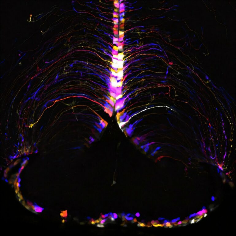 Key players in brain aging: New research identifies age-related ...