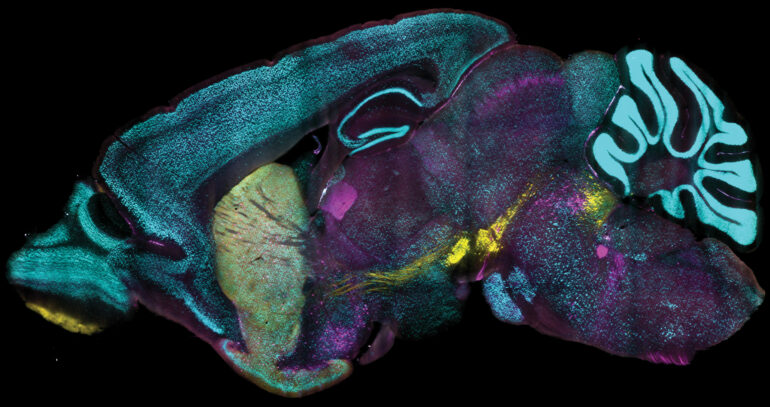 New method enables protein labeling of tens of millions of densely ...