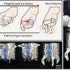 Robotic gripper mimics human hand to move multiple objects together