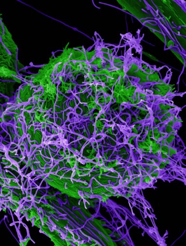 Study traces Ebola's route to the skin surface