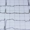 Why is obesity linked to irregular heart rhythms? Researchers ...