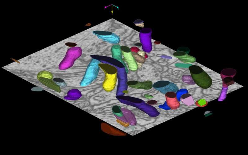 Automatic cell analysis with the help of artificial intelligence