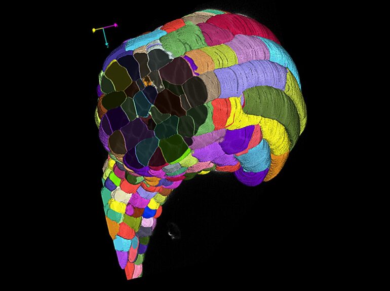 Automatic cell analysis: AI-powered software 'segments anything ...