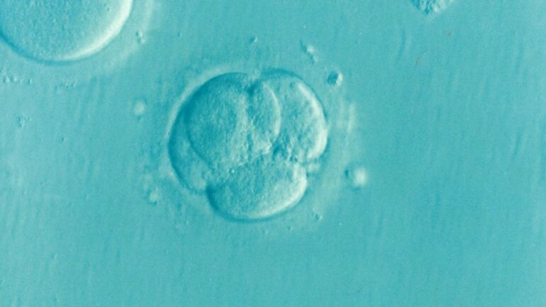 How do cells respond to changes? New study finds it's not all in ...