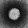 Speculum exams unnecessary for HPV screening: Research finds self ...