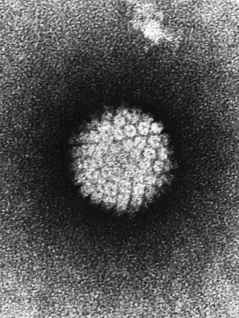 Speculum exams unnecessary for HPV screening: Research finds self ...