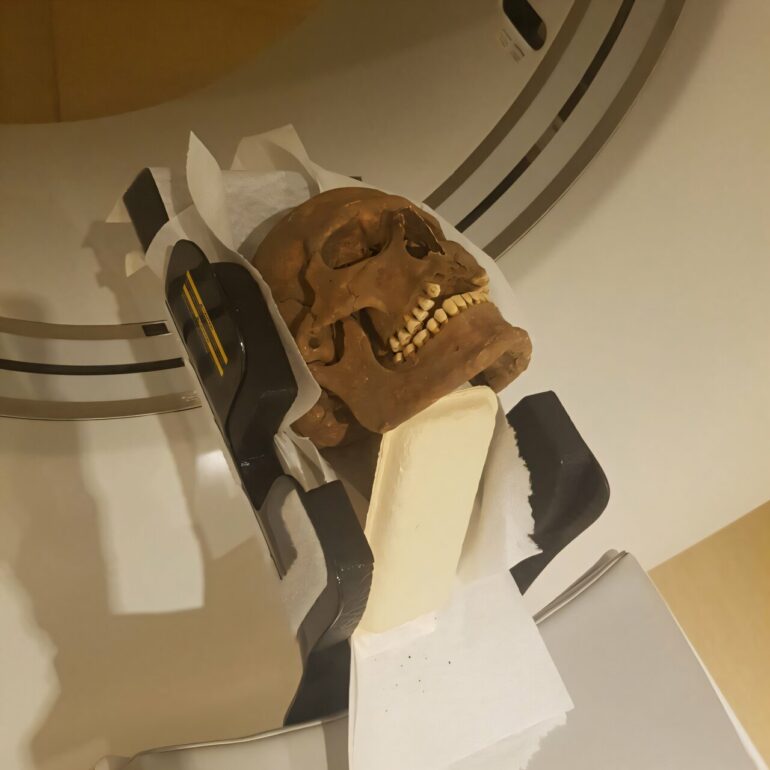 Viking skulls inspected with CT scans reveal severe morbidity