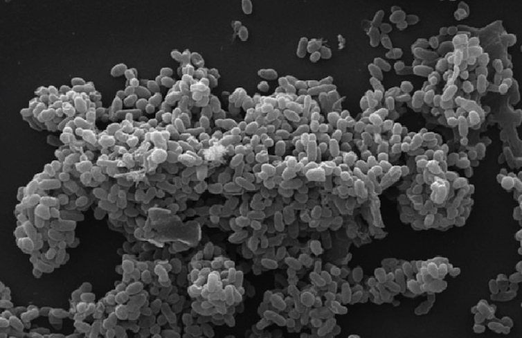 Microscopy image of large clump of rod-like bacteria