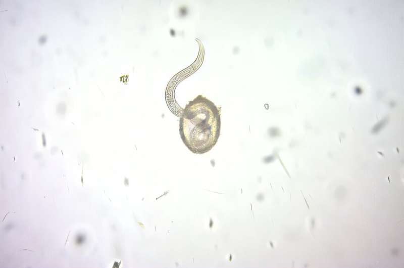 Park entrances may be hotspots for infective dog roundworm eggs