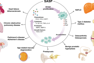 Aging and aging-related diseases: from molecular mechanisms to ...