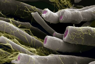 Out-Of-Balance Bacteria Is Linked To Multiple Sclerosis − The ...