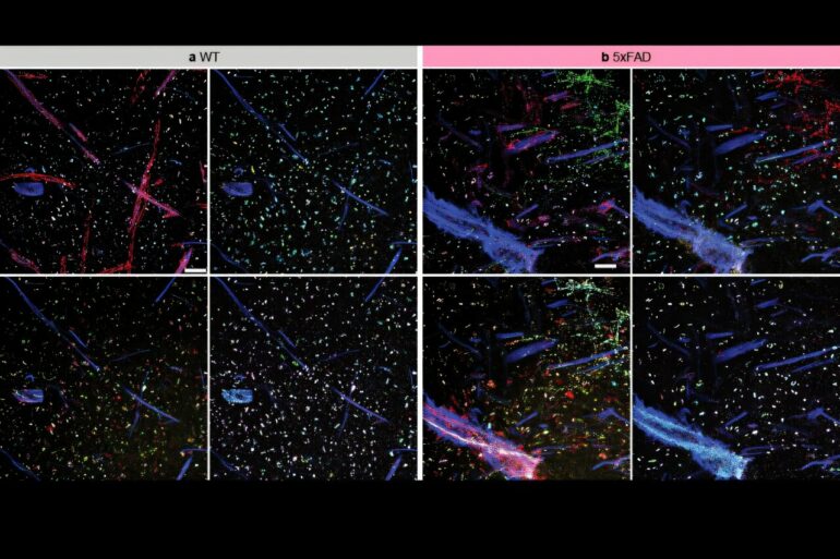 Seeing more in expansion microscopy: New methods light up lipid ...