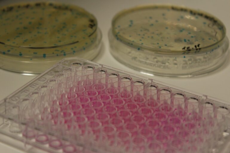 Study uncovers the core principles of low-resistance antibiotics