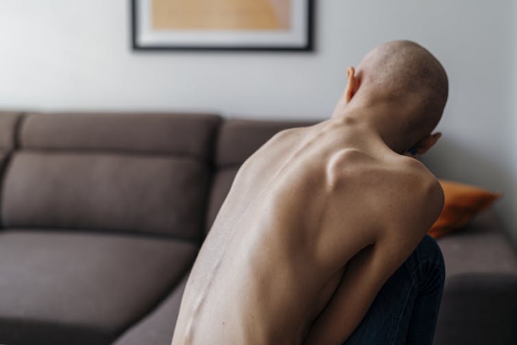 Close-up of a person's skeletal back and bald head from behind