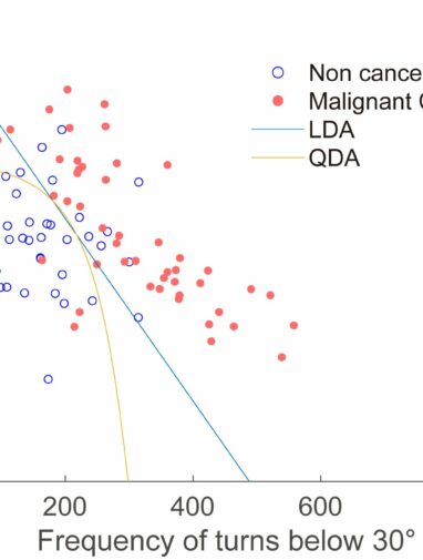 Scientists can tell healthy and cancerous cells apart by how they move