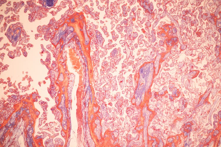 Microscopy image of human placenta and umbillical cord