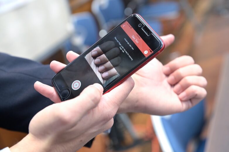 A photo of a fingernail can now be used to detect and monitor for ...