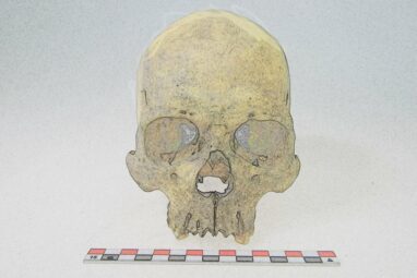 Ancient DNA reveals rare leprosy strain existed in the Americas ...