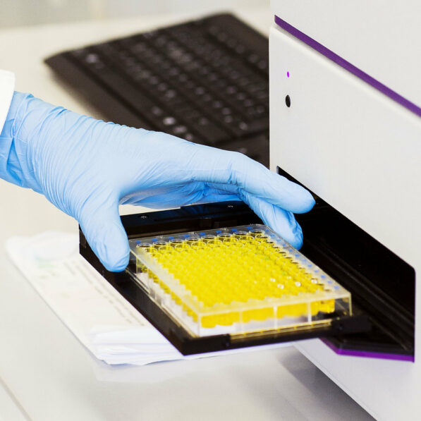 Beta-carotene keeps enzymes active under heavy load