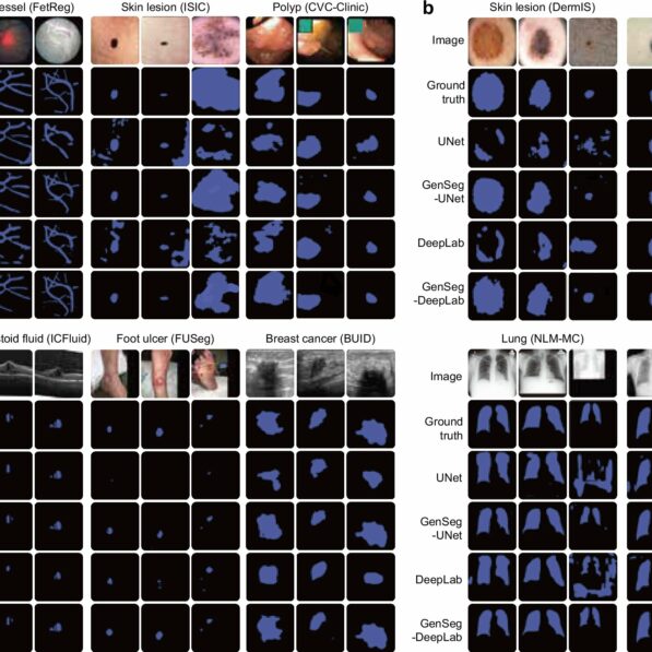 New AI tool learns to read medical images with far less data