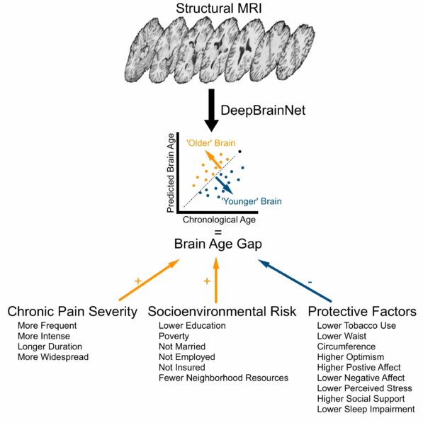 Healthy habits can make your brain age more slowly, study finds