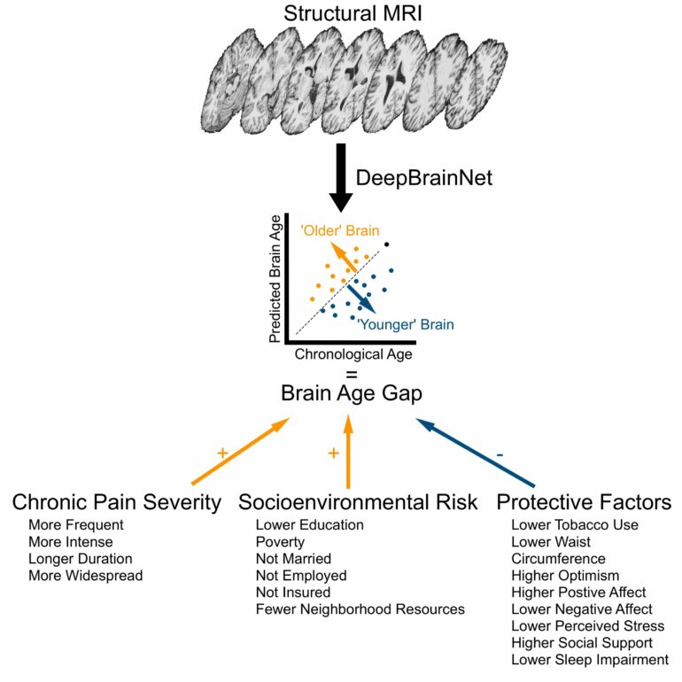 Healthy habits can make your brain age more slowly, study finds