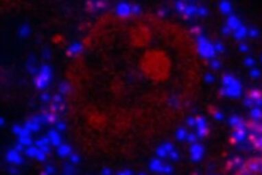 Microplastics linked to impaired bone health