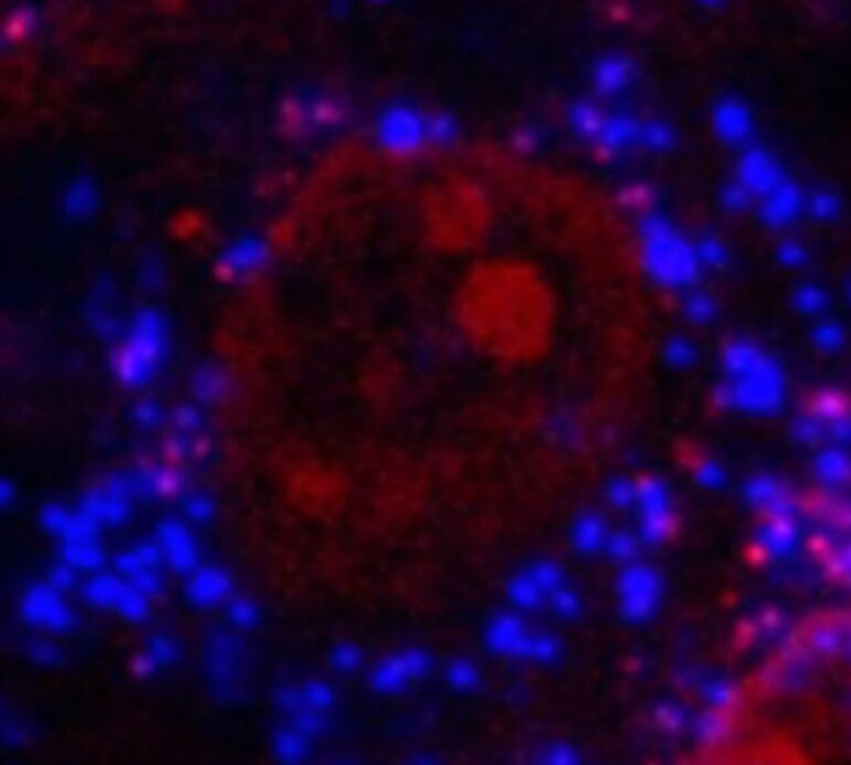 Microplastics linked to impaired bone health