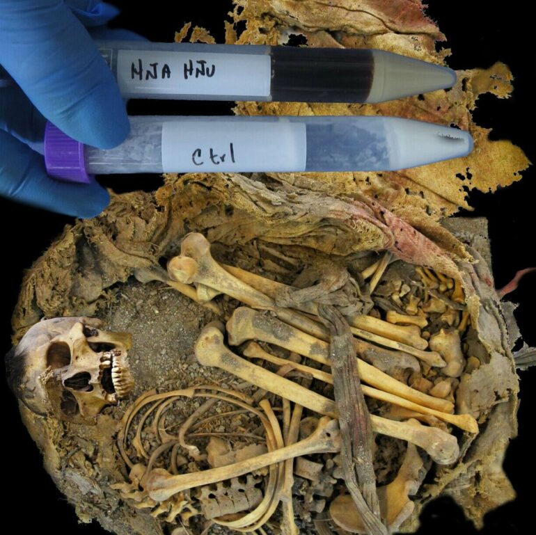 1,000-year-old gut microbiome revealed for young man who lived in ...