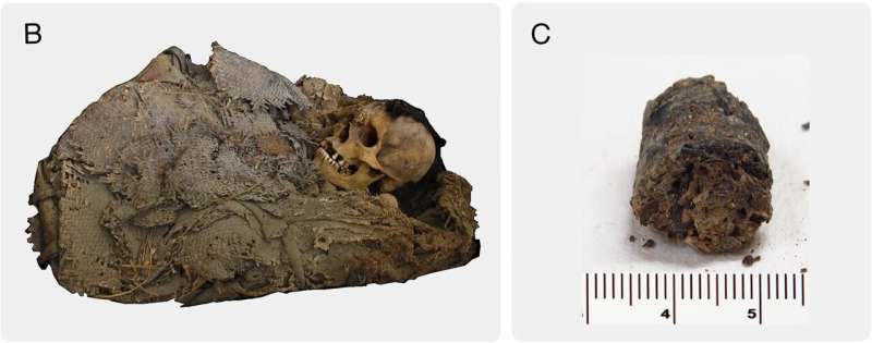 1,000-year-old gut microbiome revealed for young man who lived in pre-Hispanic Mexico
