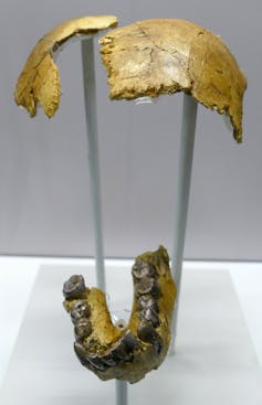 parts of skull and human jaw in a display
