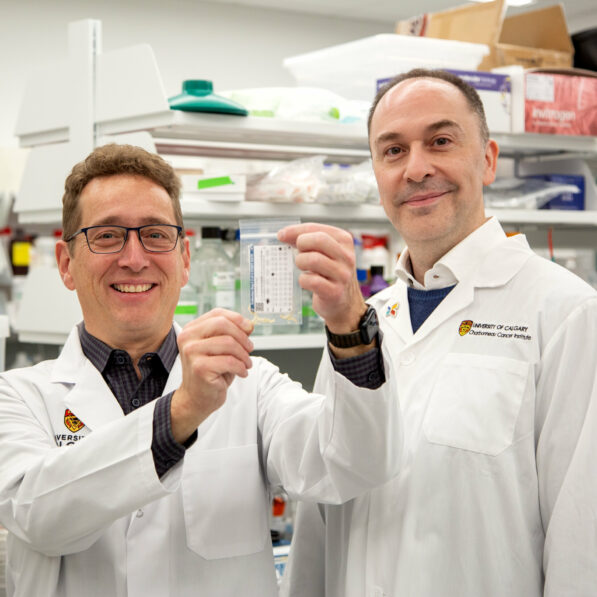 Scientists are collecting toenail clippings to reveal radon ...