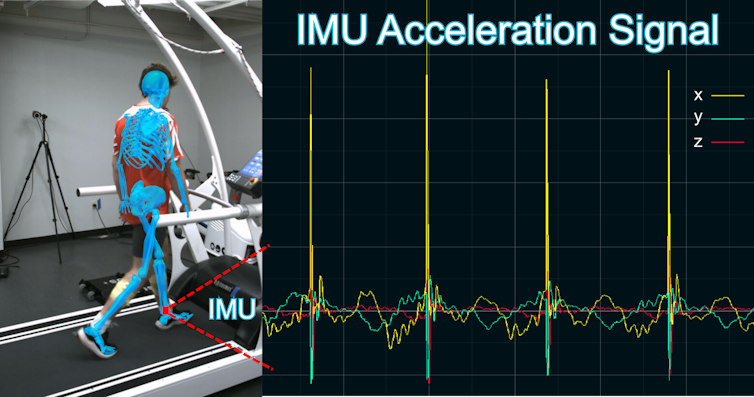 On the left, an illustration of a skeleton overlays a photo of a person on a treadmill; on the right, a series of horizontal jagged lines