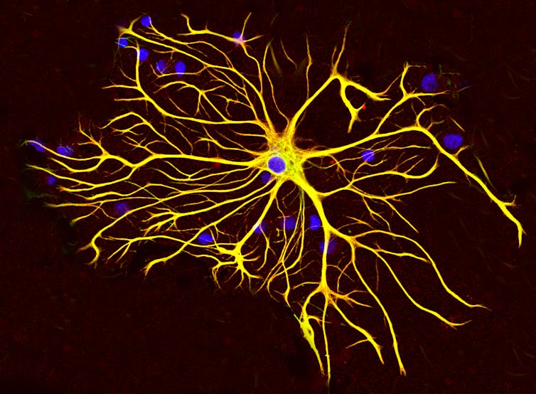 Neuron with many arms extending from a central body
