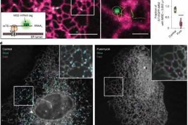 How cells orchestrate protein production through ER-lysosome ...