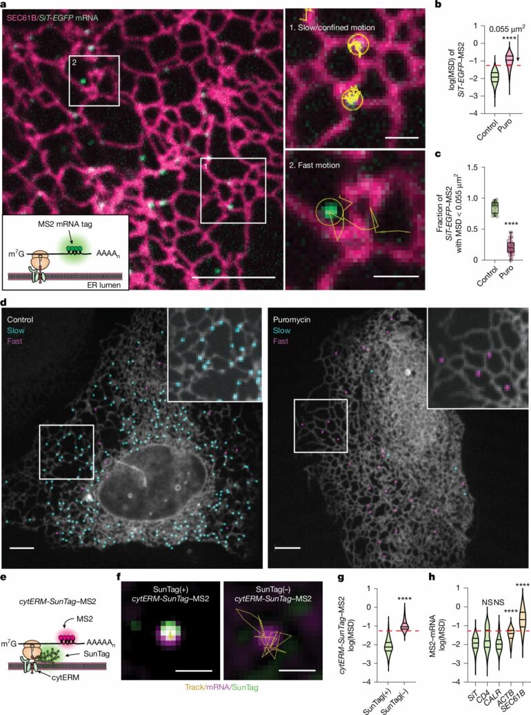 How cells orchestrate protein production through ER-lysosome ...