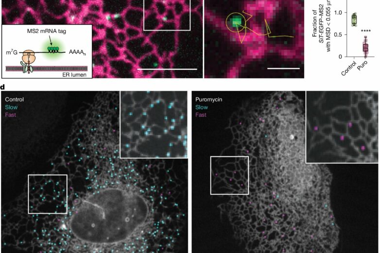 How cells orchestrate protein production through ER-lysosome ...