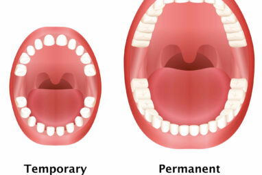 Baby Teeth vs. Permanent Teeth: The Difference - Sedaros Oral Surgery