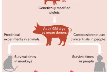 The Future of Transplanting Pig Organs in People