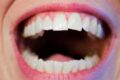 Sugar starts corroding your teeth within seconds. Here's how to ...
