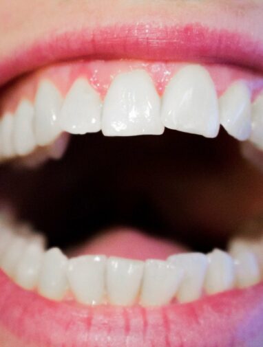 Sugar starts corroding your teeth within seconds. Here's how to ...