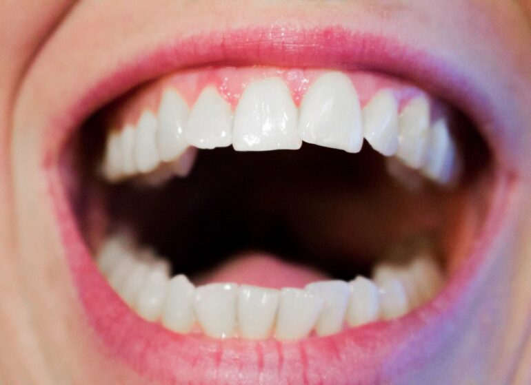 Sugar starts corroding your teeth within seconds. Here's how to ...