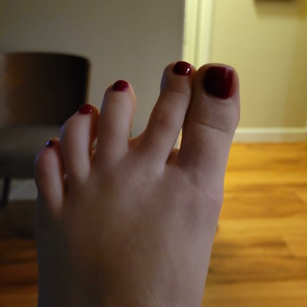 Toes keep cramping and moving to the side in their own. I can't ...