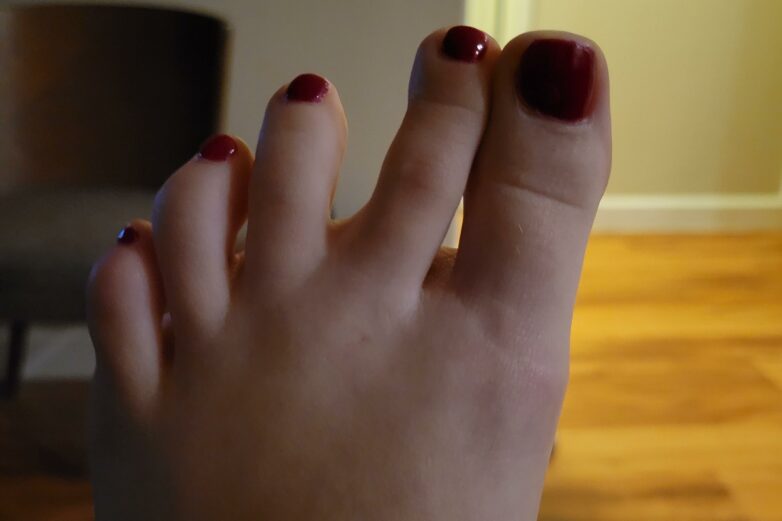 Toes keep cramping and moving to the side in their own. I can't ...